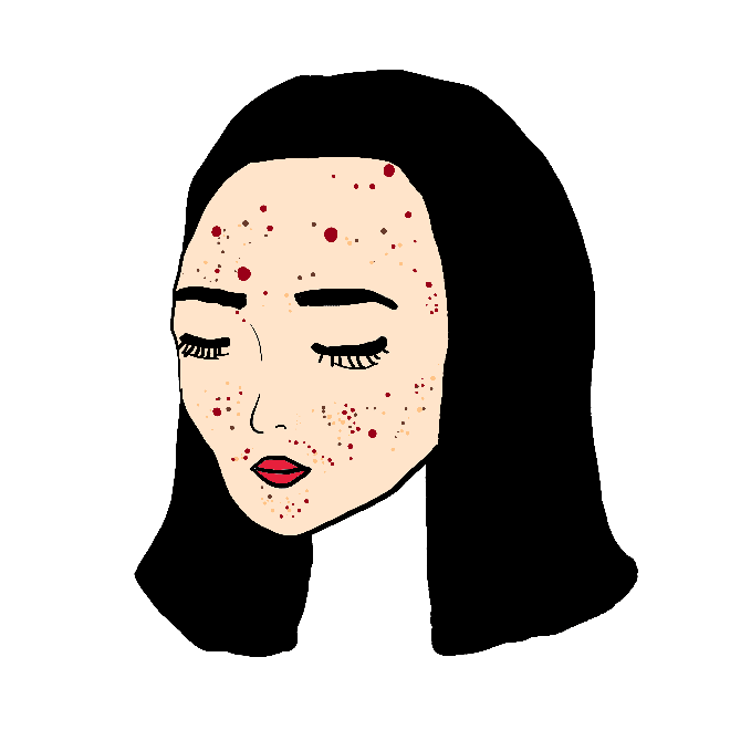 Mujer con acne gif